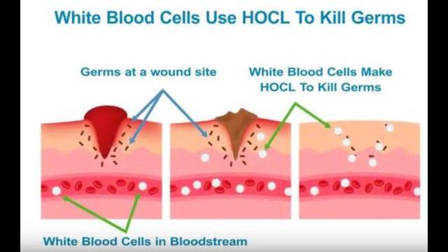 Calcium Hypochlorite (MMS 2): How I Make & Take this Powerful Medicine 21-7-2021