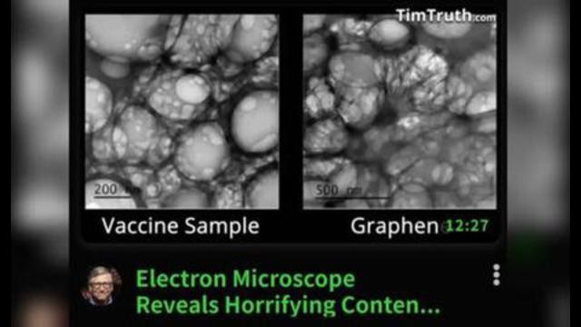 ELECTRON MICROSCOPE REVEALS HORRIFYING CONTENTS OF COVID-19 VACCINE! 8-7-2021