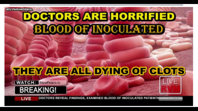 WARNING !! HORRIFIC FINDINGS IN BLOOD OF THE VACCINATED - EXPERTS ALL AGREE - THESE SHOTS ARE LETHAL 24-8-2021