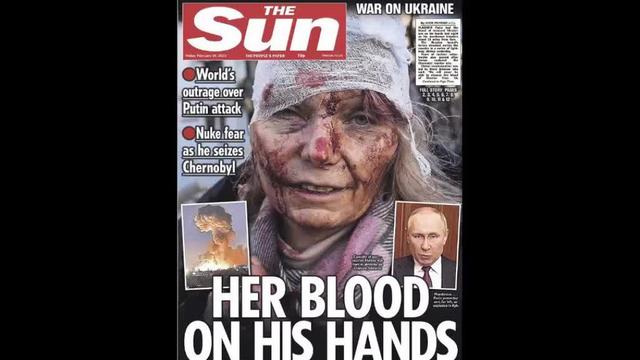 A very BLOODY CRISIS ACTOR and more FAKE NEWS from Ukraine 27-2-2022