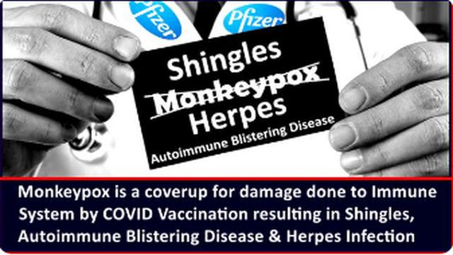 MONKEYPOX ! ( ANOTHER ) COVERUP FOR COV-ID INJECTION ( ADVERSE EFFECTS ) INJURY 11-6-2022