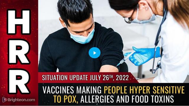 Situation Update, July 26, 2022 - Vaccines making people HYPER sensitive to POX, allergies and FOOD 26-7-2022