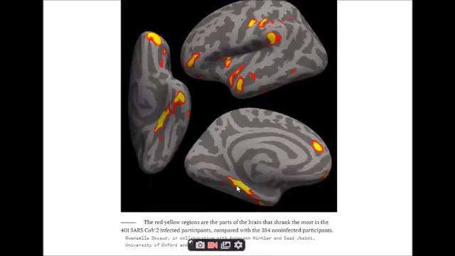 Graphene Causes A Massive Drop In IQ 27-12-2022