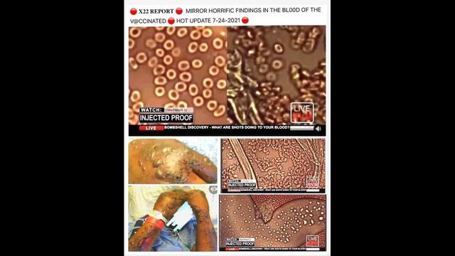 VITAL - The truth about parasites and illness, people do not know 25-12-2022