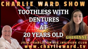 TOOTHLESS WITH DENTURES AT 20 YEARS OLD WITH CHEYENNE & CHARLIE WARD 15-4-2032
